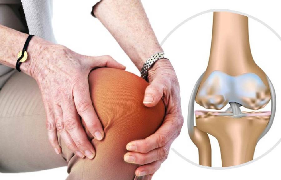 biến chứng của thoái hoá khớp