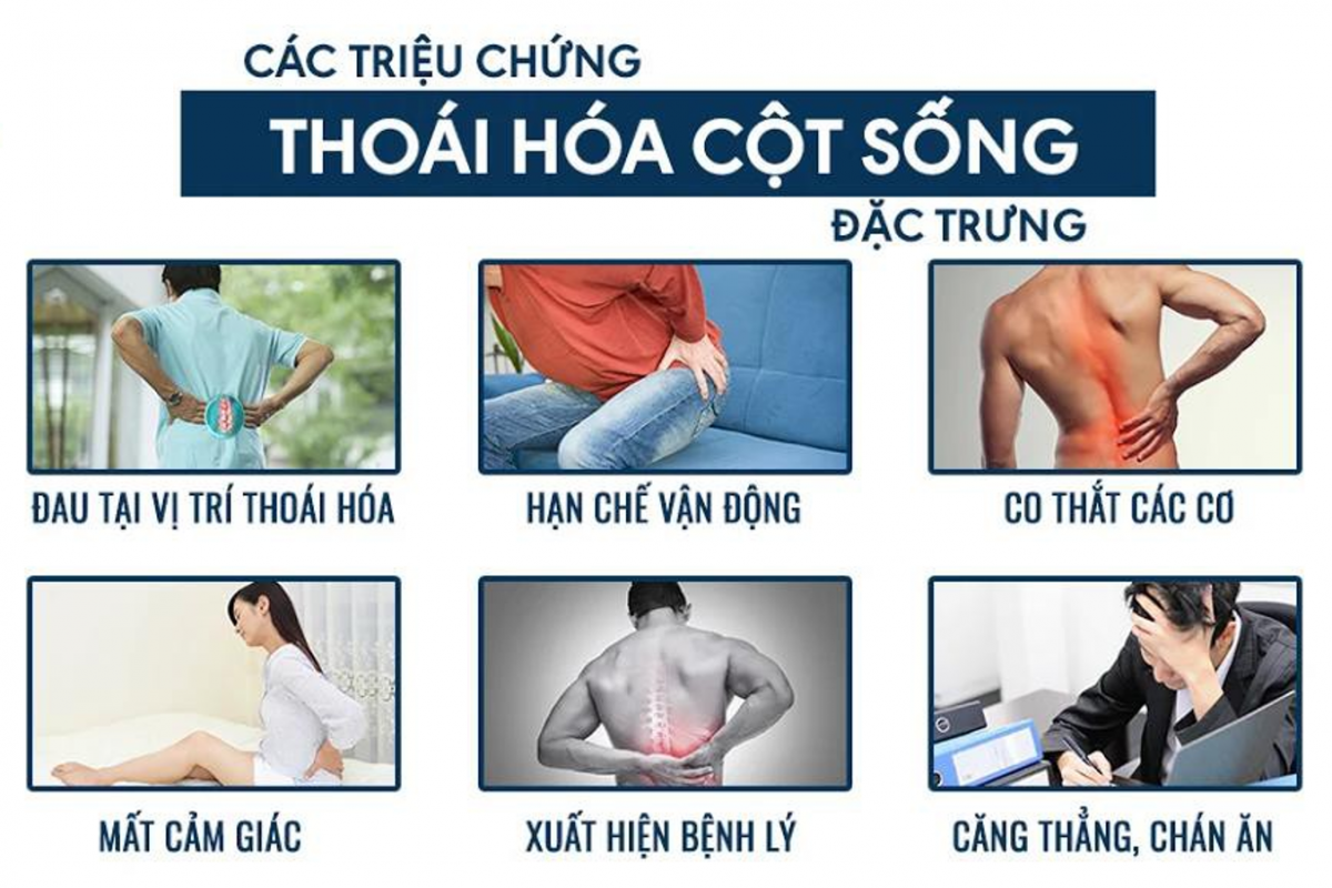 Làm thế nào để biết được mình bị thoái hóa cột sống thắt lưng