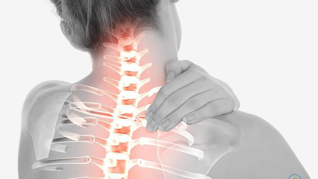 thoái hoá đốt sống cổ