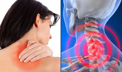 Vì sao dân văn phòng hay đau vai gáy