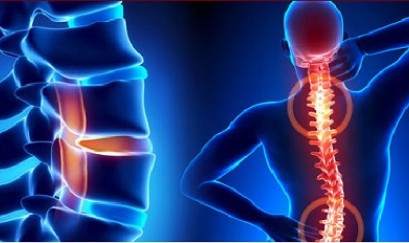 Các triệu chứng thoái hóa cột sống thắt lưng